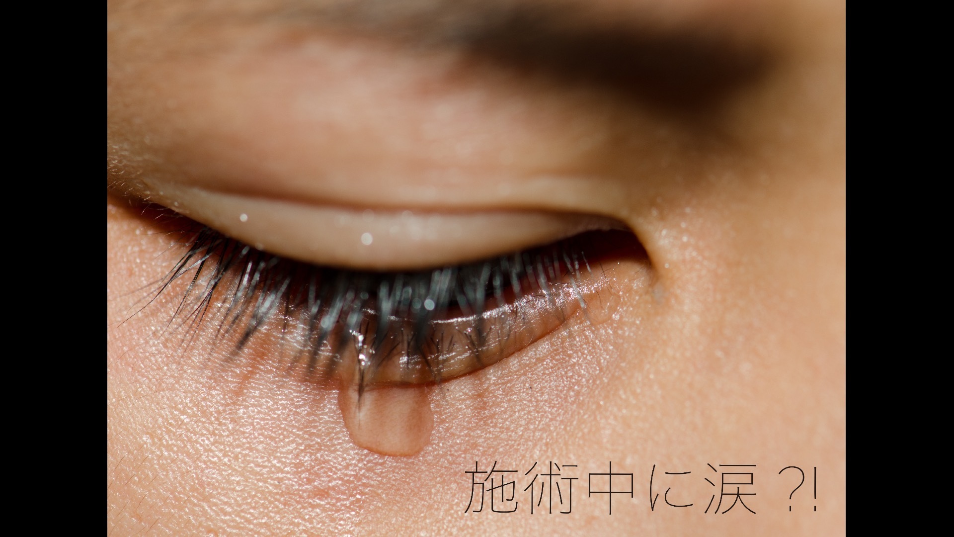 施術中に涙?!